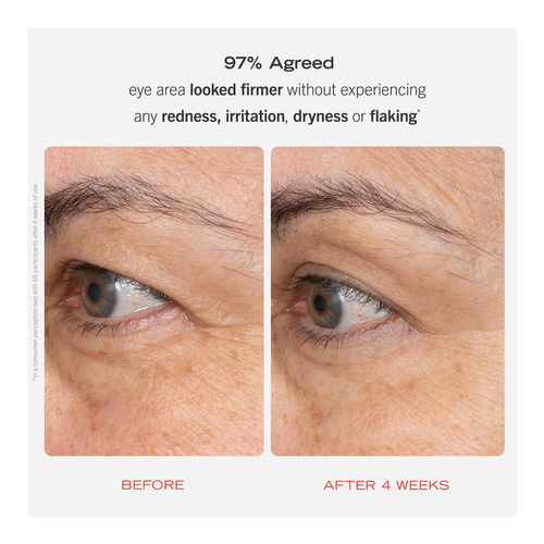 Retinol Eye Cream slider