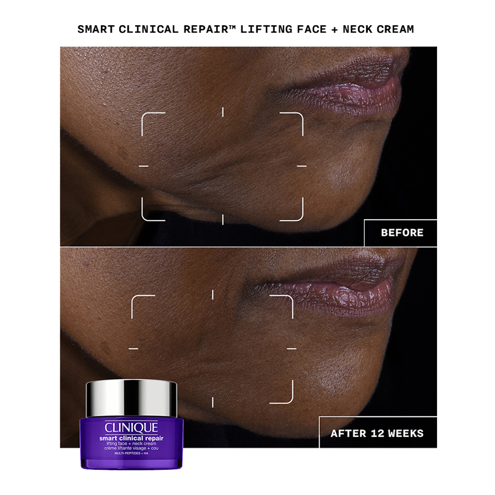 Smart Clinical Repair Lifting Face + Neck Cream slider