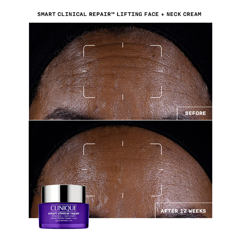 Smart Clinical Repair Lifting Face + Neck Cream slider