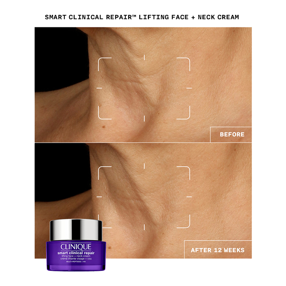 Smart Clinical Repair Lifting Face + Neck Cream slider