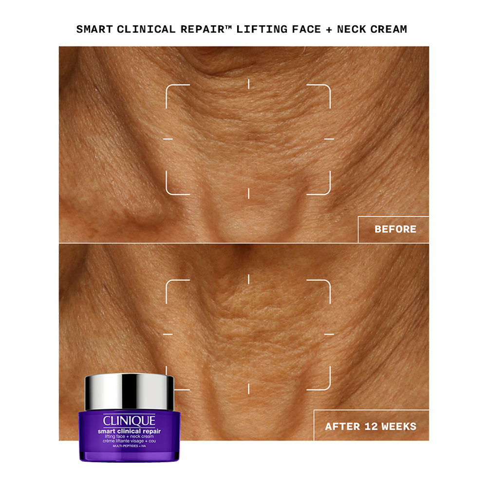 Smart Clinical Repair Lifting Face + Neck Cream slider