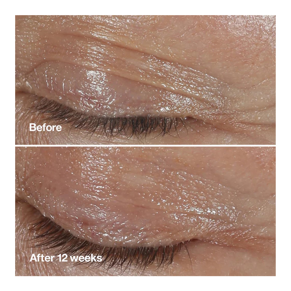 Smart Clinical Repair™ Wrinkle Correcting Eye Cream slider