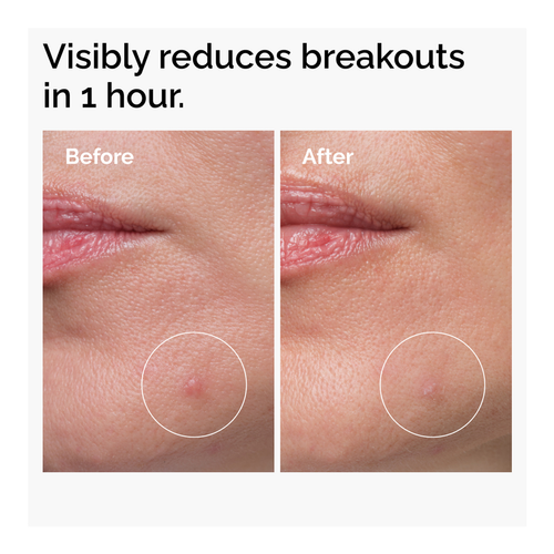 Sulfur 10% Powder-To-Cream Concentrate slider